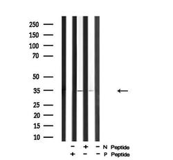 Invitrogen Phospho-Cyclin D1 (Ser90) Polyclonal Antibody 100 &mu;L | Buy Online | Invitrogen&trade; | Fisher Scientific