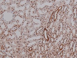 Invitrogen Phospho-4EBP1 (Thr36) Polyclonal Antibody 100 &mu;L; Unconjugated:Antibodies,