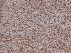Invitrogen Phospho-4EBP1 (Thr36) Polyclonal Antibody 100 &mu;L; Unconjugated:Antibodies,