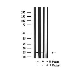Invitrogen Phospho-4EBP1 (Thr36) Polyclonal Antibody 100 &mu;L; Unconjugated:Antibodies,