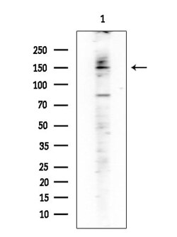 Invitrogen Phospho-DAPK1 (Ser308) Polyclonal Antibody 100 &mu;L | Buy Online | Invitrogen&trade; | Fisher Scientific