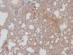 Invitrogen Phospho-DAPK1 (Ser308) Polyclonal Antibody 100 &mu;L | Buy Online | Invitrogen&trade; | Fisher Scientific