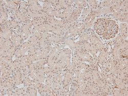 Invitrogen Phospho-DAPK1 (Ser308) Polyclonal Antibody 100 &mu;L | Buy Online | Invitrogen&trade; | Fisher Scientific