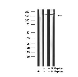 Invitrogen Phospho-ErbB2 (HER-2) (Tyr1139) Polyclonal Antibody 100 μL;