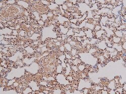 Invitrogen Phospho-PDGFRA (Tyr762) Polyclonal Antibody 100 &mu;L; Unconjugated:Antibodies,