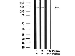Invitrogen Phospho-PDGFRA (Tyr762) Polyclonal Antibody 100 &mu;L; Unconjugated:Antibodies,