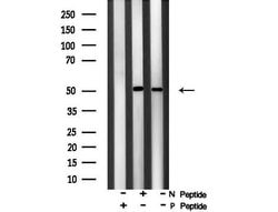 Invitrogen Phospho-PPAR alpha (Ser21) Polyclonal Antibody 100 &mu;L; Unconjugated:Antibodies,