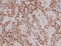 Invitrogen Phospho-RET (Tyr1096) Polyclonal Antibody 100 &mu;L; Unconjugated:Antibodies,
