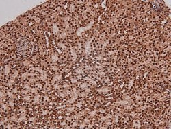 Invitrogen Phospho-RET (Tyr1096) Polyclonal Antibody 100 &mu;L; Unconjugated:Antibodies,