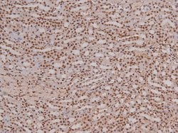 Invitrogen Phospho-RET (Tyr1096) Polyclonal Antibody 100 &mu;L; Unconjugated:Antibodies,