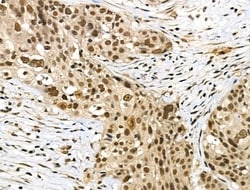 Invitrogen Phospho-SMAD2 (Ser255) Polyclonal Antibody 100 μL; Unconjugated:Antibodies,