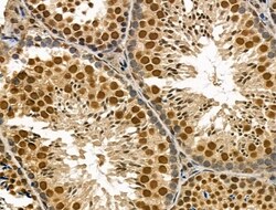 Invitrogen Phospho-SMAD2 (Ser255) Polyclonal Antibody 100 μL; Unconjugated:Antibodies,