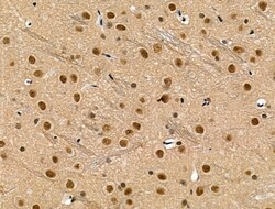 Invitrogen Phospho-SMAD2 (Ser255) Polyclonal Antibody 100 μL; Unconjugated:Antibodies,