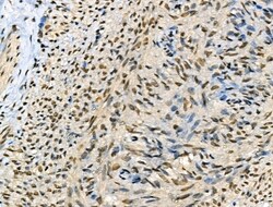 Invitrogen Phospho-SMAD2 (Ser255) Polyclonal Antibody 100 μL; Unconjugated:Antibodies,