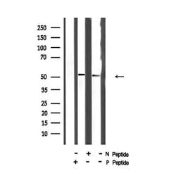 Invitrogen Phospho-SMAD2 (Ser245) Polyclonal Antibody 100 &mu;L | Buy Online | Invitrogen&trade; | Fisher Scientific