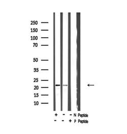 Invitrogen Phospho-Syndecan 4 (Ser179) Polyclonal Antibody 100 &mu;L; Unconjugated:Antibodies,