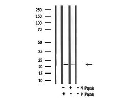 Invitrogen Phospho-HAND1 (Ser98) Polyclonal Antibody 100 &mu;L; Unconjugated:Antibodies,