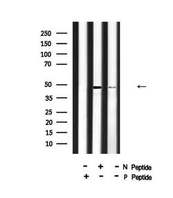 Invitrogen Phospho-HIC5 (Tyr60) Polyclonal Antibody 100 μL; Unconjugated:Antibodies,