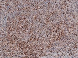Invitrogen Phospho-HMGN2 (Ser29) Polyclonal Antibody 100 &mu;L; Unconjugated:Antibodies,