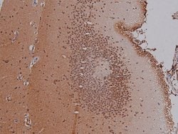 Invitrogen Phospho-HMGN2 (Ser29) Polyclonal Antibody 100 &mu;L; Unconjugated:Antibodies,