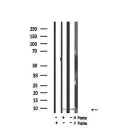 Invitrogen Phospho-HMGN2 (Ser29) Polyclonal Antibody 100 &mu;L; Unconjugated:Antibodies,