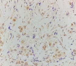 Invitrogen Phospho-HSF1 (Ser307) Polyclonal Antibody 100 &mu;L; Unconjugated:Antibodies,
