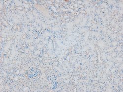 Invitrogen Phospho-ITGA4 (Ser1027) Polyclonal Antibody 100 μL; Unconjugated:Antibodies,