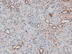 Invitrogen Phospho-ITK (Tyr512) Polyclonal Antibody 100 &mu;L | Buy Online | Invitrogen&trade; | Fisher Scientific
