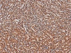 Invitrogen Phospho-ITK (Tyr512) Polyclonal Antibody 100 &mu;L | Buy Online | Invitrogen&trade; | Fisher Scientific