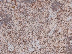 Invitrogen Phospho-ITK (Tyr512) Polyclonal Antibody 100 &mu;L | Buy Online | Invitrogen&trade; | Fisher Scientific