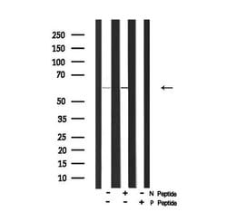 Invitrogen Phospho-ITK (Tyr512) Polyclonal Antibody 100 &mu;L | Buy Online | Invitrogen&trade; | Fisher Scientific