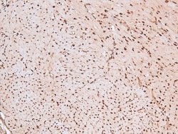 Invitrogen Phospho-MARK Pan (Thr215) Polyclonal Antibody 100 &mu;L; Unconjugated:Antibodies,