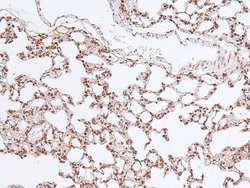 Invitrogen Phospho-MARK Pan (Thr215) Polyclonal Antibody 100 &mu;L; Unconjugated:Antibodies,