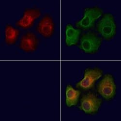 Invitrogen Phospho-MARK2 (Thr596) Polyclonal Antibody 100 &mu;L; Unconjugated:Antibodies,
