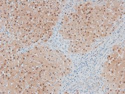 Invitrogen Phospho-MARK2 (Thr596) Polyclonal Antibody 100 &mu;L; Unconjugated:Antibodies,