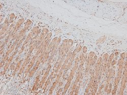 Invitrogen Phospho-MARK2 (Thr596) Polyclonal Antibody 100 &mu;L; Unconjugated:Antibodies,