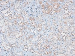 Invitrogen Phospho-MAX (Ser2) Polyclonal Antibody 100 &mu;L | Buy Online | Invitrogen&trade; | Fisher Scientific