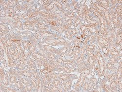Invitrogen Phospho-MAX (Ser2) Polyclonal Antibody 100 &mu;L | Buy Online | Invitrogen&trade; | Fisher Scientific