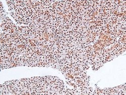 Invitrogen Phospho-MLK3 (Thr277, Ser281) Polyclonal Antibody 100 &mu;L;
