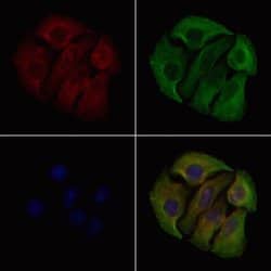 Invitrogen Phospho-Catenin alpha-1 (Ser641) Polyclonal Antibody 100 &mu;L;