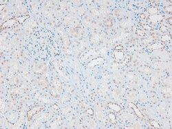 Invitrogen Phospho-Catenin alpha-1 (Ser641) Polyclonal Antibody 100 &mu;L;