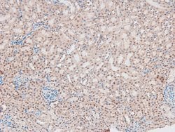 Invitrogen Phospho-Catenin alpha-1 (Ser641) Polyclonal Antibody 100 &mu;L;