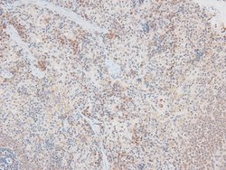 Invitrogen Phospho-Catenin alpha-1 (Ser641) Polyclonal Antibody 100 &mu;L;