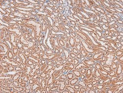 Invitrogen Phospho-AHNAK (Ser5784) Polyclonal Antibody 100 μL; Unconjugated:Antibodies,