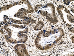 Invitrogen Phospho-p300 (Ser1834) Polyclonal Antibody 100 &mu;L | Buy Online | Invitrogen&trade; | Fisher Scientific