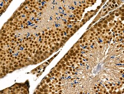 Invitrogen Phospho-p300 (Ser1834) Polyclonal Antibody 100 &mu;L | Buy Online | Invitrogen&trade; | Fisher Scientific