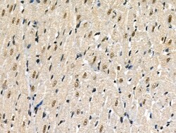 Invitrogen Phospho-p300 (Ser1834) Polyclonal Antibody 100 &mu;L | Buy Online | Invitrogen&trade; | Fisher Scientific
