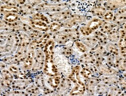 Invitrogen Phospho-p300 (Ser1834) Polyclonal Antibody 100 &mu;L | Buy Online | Invitrogen&trade; | Fisher Scientific