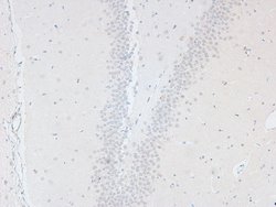Invitrogen Phospho-L-Plastin (Ser5) Polyclonal Antibody 100 &mu;L; Unconjugated:Antibodies,