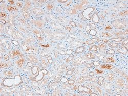 Invitrogen Phospho-DNA ligase IV (Thr650) Polyclonal Antibody 100 &mu;L;